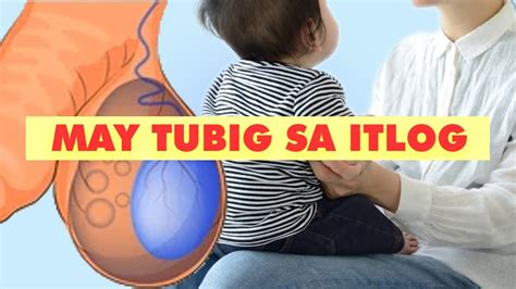 Qanda Luslos Hernia Tubig Sa Itlog Hydrocele At Spirulina Youtube