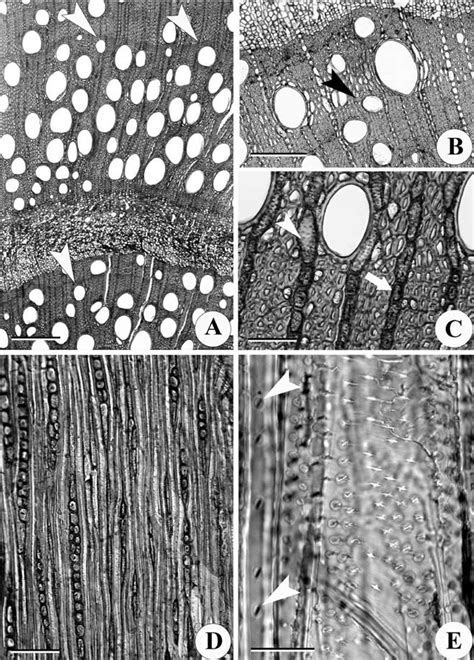 Transverse A C And Tangential Longitudinal D E View Of Secondary Download Scientific