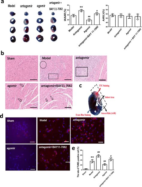 Mir P Improved Myocardial I R Injury In Mice A Evans Blue And Ttc