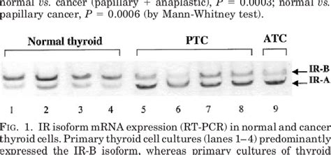 Figure 1 From A Novel Autocrine Loop Involving Igf Ii And The Insulin