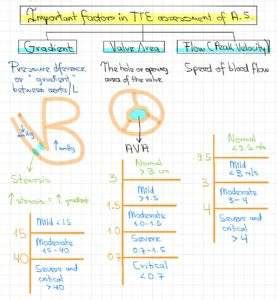 USMLE Approach to heart murmur questions – Ecuadoctors 