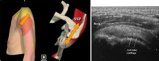 Shoulder Ultrasound Technique