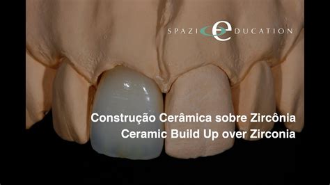 Construção Cerâmica Sobre Zircônia Ceramic Build up over Zirconia