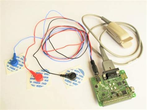 Build your own patient monitor with a Raspberry Pi