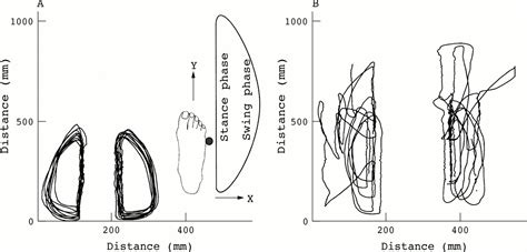 Typical Features Of Cerebellar Ataxic Gait Journal Of Neurology