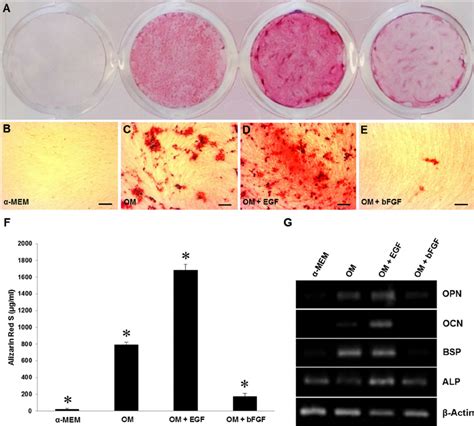 Mineralization And Gene Expression Of Osteoblast Markers A E Cells