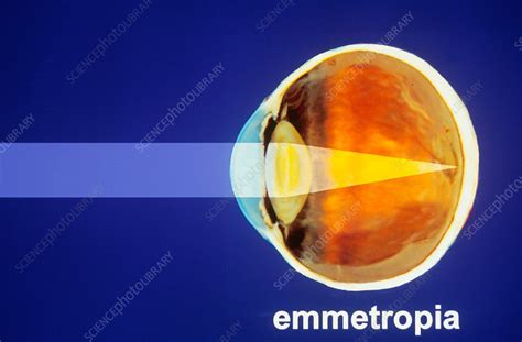 Emmetropia Diagram - Stock Image - C004/8227 - Science Photo Library