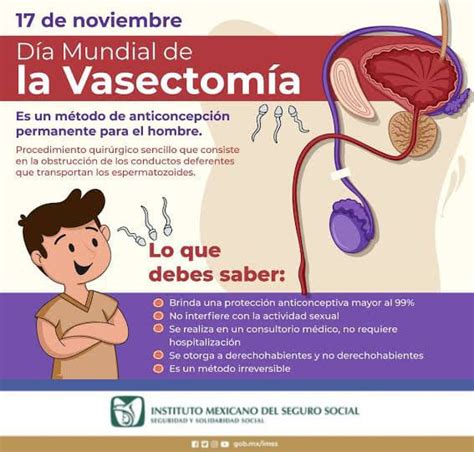 IMSS invita a semana de vasectomías Coatza Digital