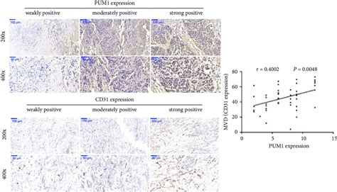 Positive Correlation Between Pum1 And Cd31 Expression In Pancreatic Download Scientific Diagram