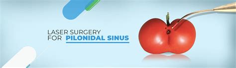 Best Pilonidal Sinus Doctor in Kolkata. Dr Purnendu Bhowmik