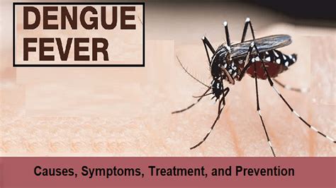 Dengue Fever Causes Symptoms Treatment Helal Medical