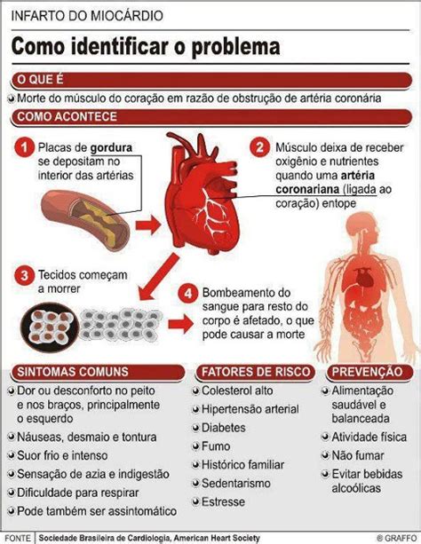 Consultoria de Enfermagem Mendes Hernandez Infarto O ataque Cardíaco