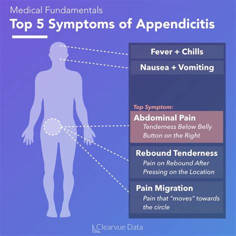 Appendicitis Signs And Symptoms