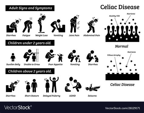 Celiac Disease Signs And Symptoms Depict Vector Image