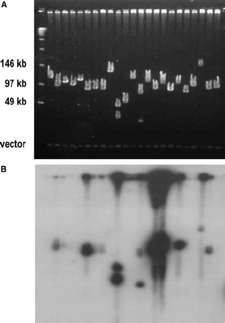 The Pulsed Field Gel Electrophoresis Pfge Analysis Of Bacterial