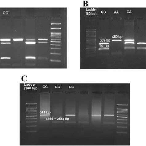 Gel Electrophoretic Separation Of PCR Products For Genotyping TP53