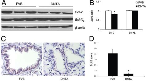 Epithelial Nf κb Activation Promotes Urethane Induced Lung