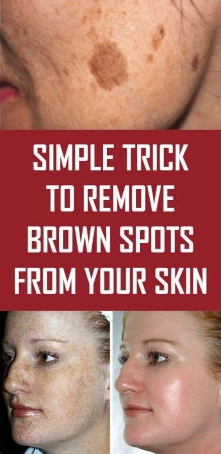 Reduce Brown Spots On Skin