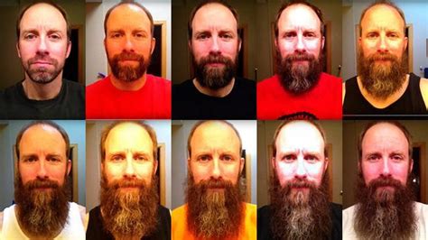 A year of beard growth for love and charity | news.com.au — Australia’s ...