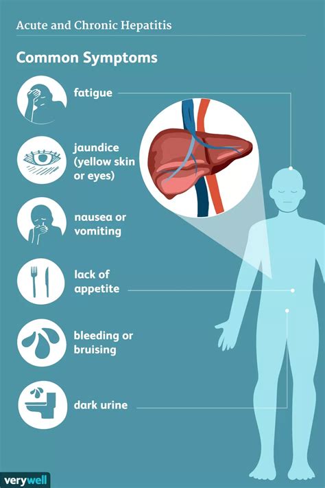 Hepatitis C ( HCV ) - MRGI - Microbiota Research Group of Iran