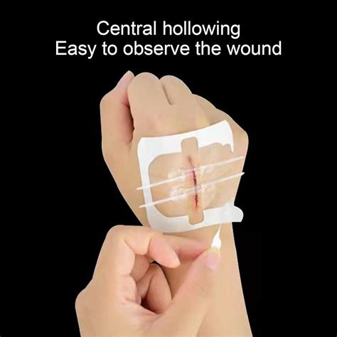 Zip Stitch Painless Waterproof Skin Closure Device For Wound Care