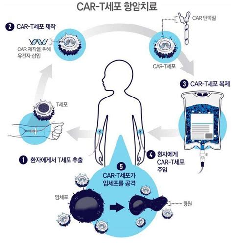 유전자 조작 면역세포 항암제로 10년 이상 효과 유지 입증 제노메딕스