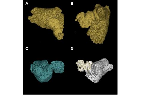 Characterisation of Left Atrial Appendage Morphology. Example images of ...