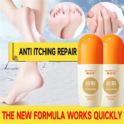 Hand Foot Crack Treatment Cream Heel Chapped Peeling Anti Dry Cracking