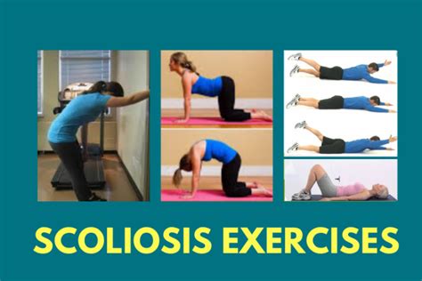 Scoliosis In Adults Scoliosis Therapy Centers