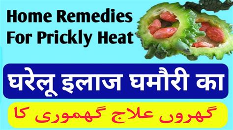 Home Remedies For Prickly Heat घरेलू इलाज घमौरी का گھروں علاج