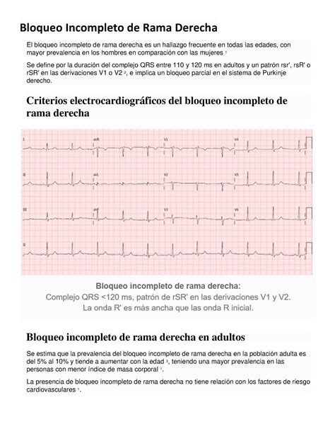 Bloqueo Incompleto de Rama Derecha Criterios electrocardiográficos