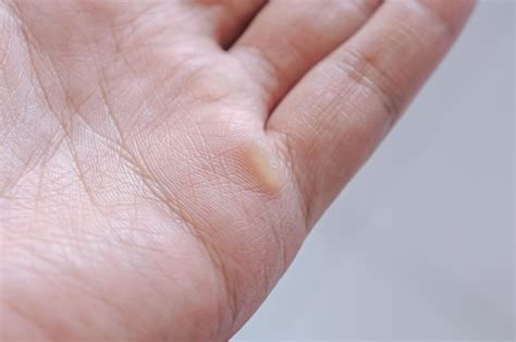 Premium Photo Selective Focus Of Man Hand With Callus On Palm