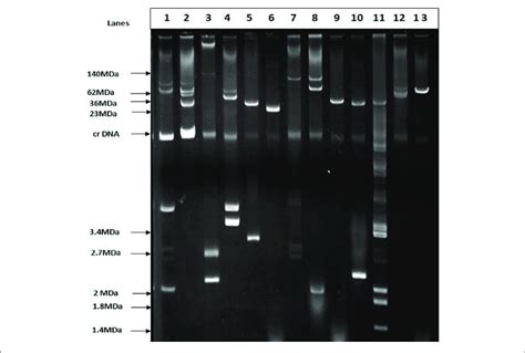 Agarose Gel Electrophoresis Of Plasmid Dna Showing The Patterns Among