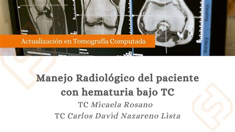 Manejo Radiol Gico Del Paciente Con Hematuria Bajo Tc Youtube