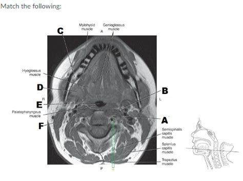 Axial Oropharynx Diagram Quizlet