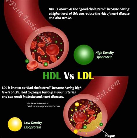 Difference in HDL and LDL | Medication Management LLC