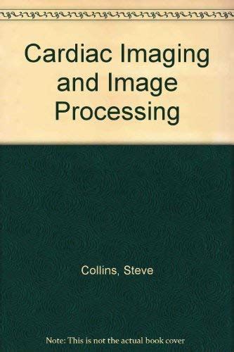 Buy Cardiac Imaging And Image Processing Book Online At Low Prices In India Cardiac Imaging