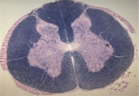Cross section through spinal cord Diagram | Quizlet