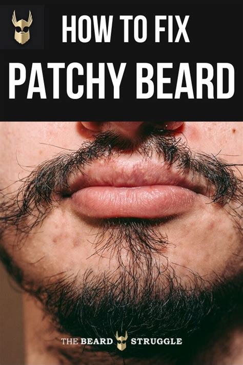 8 Proven Routines To Fix Your Patchy Beard Backed By Research The