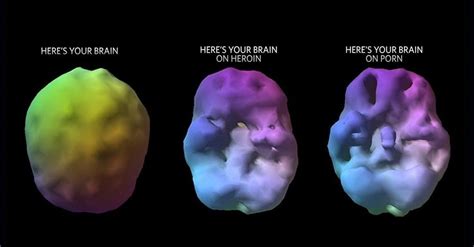 This Is Your Brain On Porn