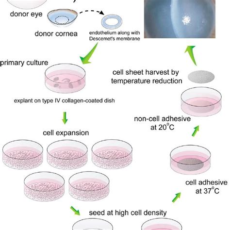 Schematic Illustration Of Human Corneal Endothelial Cell Sheet Harvest Download Scientific