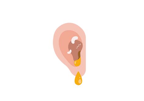 Ear Infection | Symptoms of Ear Infections & Treatment | Buoy Health