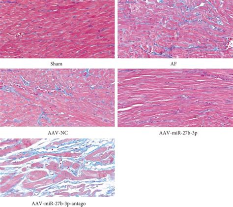 Effects Of Mir B P Overexpression On Atrial Fibrosis N For Each