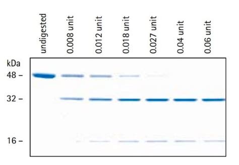 Enterokinase Cleavage Capture Kit | Sigma-Aldrich