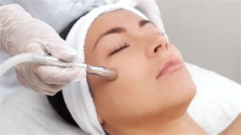 Microdermabrasion Before and After One Treatment - Costhetics