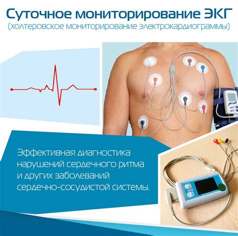 Холтеровское мониторирование экг (холтер-мониторинг). расшифровка холтера