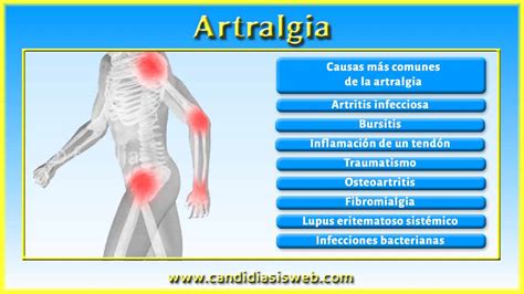 Otros Síntomas Artralgia