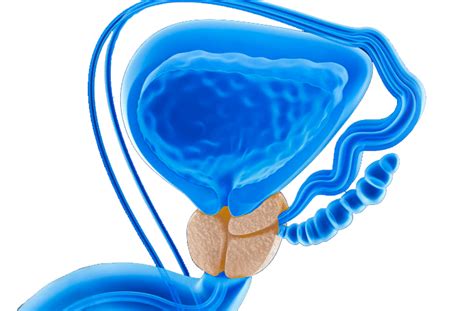 Veridium Urologia Cirurgia Robótica Câncer De Próstata Câncer De Rim