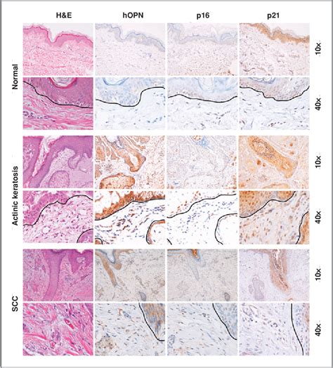 Figure From Osteopontin Stimulates Preneoplastic Cellular