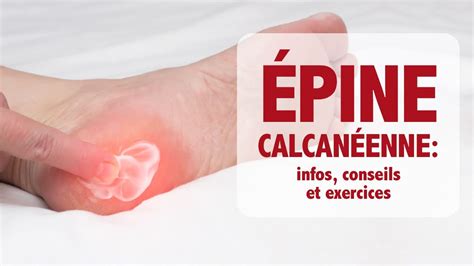 Épine calcanéenne de Lenoir informations conseils et exercices